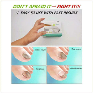 Nail Fungus Laser Onychomycosis Treatment Cold Fungal Therapy Device